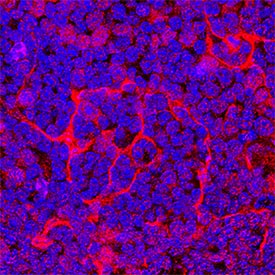 CCL11/Eotaxin was detected in perfusion fixed frozen sections of mouse thymus using Goat Anti-Mouse CCL11/Eotaxin Antigen Affinity-purified Polyclonal Antibody (Catalog # AF-420-NA) at 5 µg/mL overnight at 4 °C. Tissue was stained using the NorthernLights™ 557-conjugated Anti-Goat IgG Secondary Antibody (red; Catalog # NL001) and counterstained with DAPI (blue). Specific staining was localized to cytoplasm. View our protocol for Fluorescent IHC Staining of Frozen Tissue Sections.
