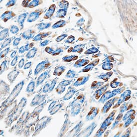 CCL11/Eotaxin was detected in perfusion fixed frozen sections of mouse colon using Goat Anti-Mouse CCL11/Eotaxin Antigen Affinity-purified Polyclonal Antibody (Catalog # AF-420-NA) at 15 µg/mL overnight at 4 °C. Tissue was stained using the Anti-Goat HRP-DAB Cell & Tissue Staining Kit (brown; Catalog # CTS008) and counterstained with hematoxylin (blue). Specific staining was localized to cytoplasm. View our protocol for Chromogenic IHC Staining of Frozen Tissue Sections.