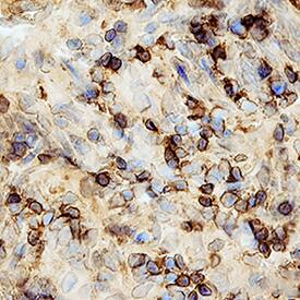 CCL11/Eotaxin was detected in perfusion fixed frozen sections of rat intestine using Rat Anti-Mouse CCL11/Eotaxin Monoclonal Antibody (Catalog # MAB420) at 15 µg/mL overnight at 4 °C. Tissue was stained using the Anti-Rat HRP-DAB Cell & Tissue Staining Kit (brown; Catalog # CTS017) and counterstained with hematoxylin (blue). Specific staining was localized to fibroblasts in submucosae. View our protocol for Chromogenic IHC Staining of Frozen Tissue Sections.