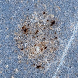 CCL17/TARC was detected in immersion fixed paraffin-embedded sections of human spleen using Goat Anti-Human CCL17/TARC Antigen Affinity-purified Polyclonal Antibody (Catalog # AF364) at 10 µg/mL overnight at 4 °C. Tissue was stained using the Anti-Goat HRP-DAB Cell & Tissue Staining Kit (brown; Catalog # CTS008) and counterstained with hematoxylin (blue). Specific staining was localized to cytoplasm in lymphocytes. View our protocol for Chromogenic IHC Staining of Paraffin-embedded Tissue Sections.