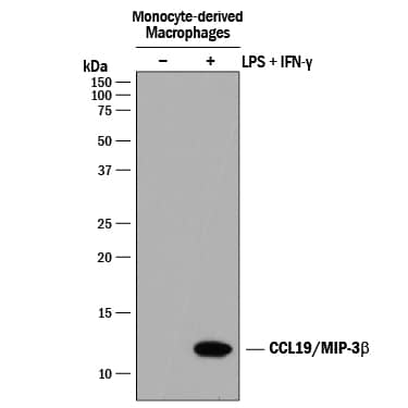 Western blot shows conditioned media from monocyte-derived macrophages untreated (-) or treated (+) with 1 µg/mL LPS and 40 ng/mL Recombinant Human IFN-gamma (Catalog # 285-IF) for 24 hours. PVDF membrane was probed with 1 µg/mL of Goat Anti-Human CCL19/MIP-3 beta  Antigen Affinity-purified Polyclonal Antibody (Catalog # AF361) followed by HRP-conjugated Anti-Goat IgG Secondary Antibody (Catalog # HAF017). A specific band was detected for CCL19/MIP-3 beta  at approximately 12 kDa (as indicated). This experiment was conducted under reducing conditions and using Immunoblot Buffer Group 1.