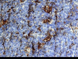 CCL19/MIP-3 beta  was detected in immersion fixed paraffin-embedded sections of human tonsil using 25 µg/mL Mouse Anti-Human CCL19/ MIP-3 beta  Monoclonal Antibody (Catalog # MAB361) overnight at 4 °C. Tissue was stained with the Anti-Mouse HRP-DAB Cell & Tissue Staining Kit (brown; Catalog # CTS002) and counter-stained with hematoxylin (blue). View our protocol for Chromogenic IHC Staining of Paraffin-embedded Tissue Sections.