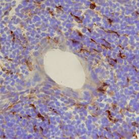 CCL21/6Ckine was detected in perfusion fixed frozen sections of mouse thymus using Mouse CCL21/6Ckine Monoclonal Antibody (Catalog # MAB457) at 25 µg/mL overnight at 4 °C. Tissue was stained using the Anti-Rat HRP-DAB Cell & Tissue Staining Kit (brown; Catalog # CTS017) and counterstained with hematoxylin (blue). Specific staining was localized to endothelial cells. View our protocol for Chromogenic IHC Staining of Frozen Tissue Sections.