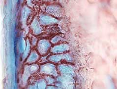 CCL27/CTACK was detected in immersion fixed frozen sections of human skin using Human CCL27/CTACK Antigen Affinity-purified Polyclonal Antibody (Catalog # AF376) at 15 µg/mL overnight at 4 °C. Tissue was stained using the Anti-Goat HRP-AEC Cell & Tissue Staining Kit (red; Catalog # CTS009) and counterstained with hemotoxylin (blue). View our protocol for Chromogenic IHC Staining of Frozen Tissue Sections.