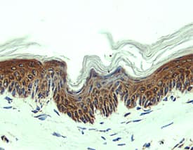 CCL27/CTACK was detected in perfusion fixed frozen sections of mouse skin using Goat Anti-Mouse CCL27/CTACK Antigen Affinity-purified Polyclonal Antibody (Catalog # AF725) at 1.7 &micro;g/mL overnight at 4 &deg;C. Tissue was stained using the Anti-Goat HRP-DAB Cell & Tissue Staining Kit (brown; Catalog # CTS008) and counterstained with hematoxylin (blue). View our protocol for Chromogenic IHC Staining of Frozen Tissue Sections.
