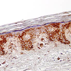 CCL27/CTACK was detected in immersion fixed paraffin-embedded sections of human skin using Mouse Anti-Human CCL27/CTACK Monoclonal Antibody (Catalog # MAB376) at 25 µg/mL overnight at 4 °C. Tissue was stained using the Anti-Mouse HRP-DAB Cell & Tissue Staining Kit (brown; Catalog # CTS002) and counterstained with hematoxylin (blue). Specific staining was localized to cytoplasm in keratinocytes. View our protocol for Chromogenic IHC Staining of Paraffin-embedded Tissue Sections.