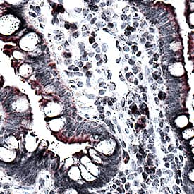 CCL2/JE/MCP-1 was detected in immersion fixed paraffin-embedded sections of human Crohn's disease intestine using Mouse Anti-Human CCL2/JE/MCP-1 Monoclonal Antibody (Catalog # MAB679) at 15 µg/mL for 1 hour at room temperature followed by incubation with the Anti-Mouse IgG VisUCyte™ HRP Polymer Antibody (VC001). Before incubation with the primary antibody, tissue was subjected to heat-induced epitope retrieval using Antigen Retrieval Reagent-Basic (CTS013). Tissue was stained using DAB (brown) and counterstained with hematoxylin (blue). Specific staining was localized to cell membranes and cytoplasm. View our protocol for IHC Staining with VisUCyte HRP Polymer Detection Reagents.