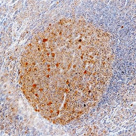 Immunohistochemistry CCL3/MIP-1 alpha Antibody [Unconjugated]