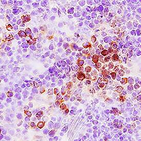 CCL3/MIP-1a was detected in perfusion fixed frozen sections of mouse thymus using Goat Anti-Mouse CCL3/MIP-1a Antigen Affinity-purified Polyclonal Antibody (Catalog # AF-450-NA) at 15 µg/mL overnight at 4 °C. Tissue was stained using the Anti-Goat HRP-DAB Cell & Tissue Staining Kit (brown; Catalog # CTS008) and counterstained with hematoxylin (blue). Specific staining was localized to cytoplasm. View our protocol for Chromogenic IHC Staining of Frozen Tissue Sections.