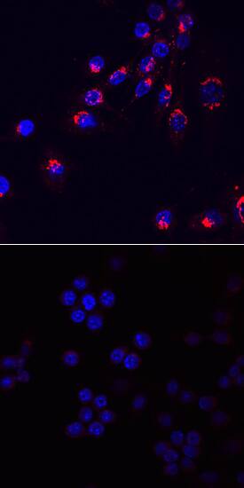 <b>Biological Strategies Validation. </b>CCL3/MIP-1a was detected in immersion fixed RAW 264.7 mouse monocyte/macrophage cell line stimulated (upper panel) or not (lower panel) with LPS using Rat Anti-Mouse CCL3/MIP-1a Monoclonal Antibody (Catalog # MAB4501) at 10 µg/mL for 3 hours at room temperature. Cells were stained using the NorthernLights™ 557-conjugated Anti-Rat IgG Secondary Antibody (red; Catalog # NL013) and counterstained with DAPI (blue). Specific staining was localized to the cytoplasm of stimulated cells. View our protocol for Fluorescent ICC Staining of Cells on Coverslips.
