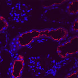 CCL3/MIP-1a was detected in perfusion fixed frozen sections of rat kidney using Mouse Anti-Rat CCL3/MIP-1a Monoclonal Antibody (Catalog # MAB66251) at 25 µg/mL overnight at 4 °C. Tissue was stained using the NorthernLights™ 557-conjugated Anti-Mouse IgG Secondary Antibody (red; Catalog # NL007) and counterstained with hematoxylin (blue). Specific staining was localized to the plasma membranes of epithelial cells in convoluted tubules. View our protocol for Fluorescent IHC Staining of Frozen Tissue Sections.
