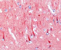 Immunohistochemistry CCL4/MIP-1 beta Antibody [Unconjugated]