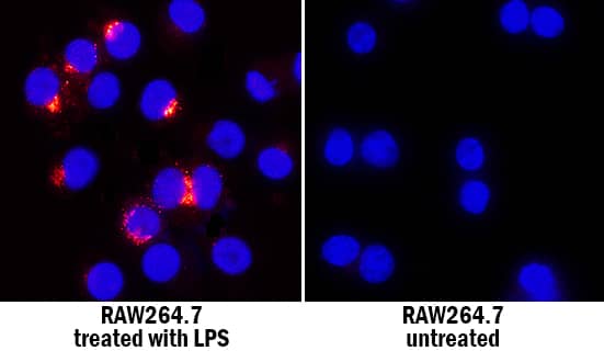 Immunocytochemistry CCL4/MIP-1 beta Antibody [Unconjugated]
