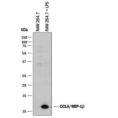 Western Blot CCL4/MIP-1 beta Antibody [Unconjugated]