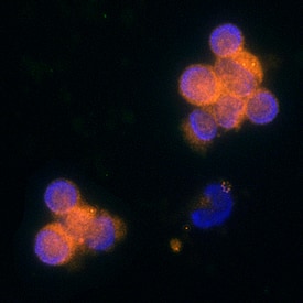 Immunocytochemistry CCL5/RANTES Antibody [Unconjugated]