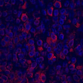 Immunohistochemistry CCL5/RANTES Antibody [Unconjugated]