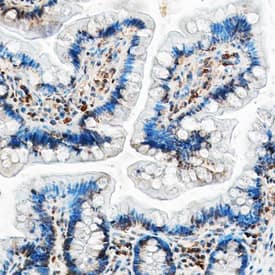 CCL5/RANTES was detected in perfusion fixed frozen sections of mouse small intestine using Mouse Anti-Human CCL5/RANTES Monoclonal Antibody (Catalog # MAB278) at 15 µg/mL overnight at 4 °C. Tissue was stained using the Anti-Mouse HRP-DAB Cell & Tissue Staining Kit (brown; Catalog # CTS002) and counterstained with hematoxylin (blue). Specific staining was localized to cytoplasm. View our protocol for Chromogenic IHC Staining of Frozen Tissue Sections.