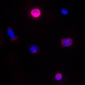 CCL5/RANTES was detected in immersion fixed canine peripheral blood mononuclear cells (PBMCs) treated with calcium ionomycin and PMA using Canine CCL5/RANTES Monoclonal Antibody (Catalog # MAB60451) at 25 µg/mL for 3 hours at room temperature. Cells were stained using the NorthernLights™ 557-conjugated Anti-Mouse IgG Secondary Antibody (red; Catalog # NL007) and counterstained with DAPI (blue). Specific staining was localized to cytoplasm. View our protocol for Fluorescent ICC Staining of Non-adherent Cells.