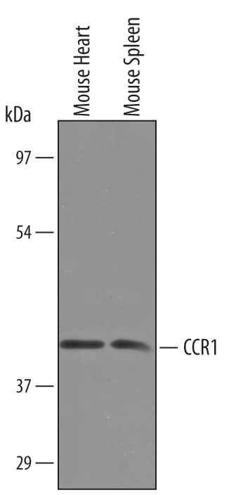 Western blot shows lysates of mouse heart tissue and mouse spleen tissue. PVDF Membrane was probed with 1 µg/mL of Sheep Anti-Mouse CCR1 Antigen Affinity-purified Polyclonal Antibody (Catalog # AF5986) followed by HRP-conjugated Anti-Sheep IgG Secondary Antibody (Catalog # HAF016). A specific band was detected for CCR1 at approximately 45 kDa (as indicated). This experiment was conducted under reducing conditions and using Immunoblot Buffer Group 8.