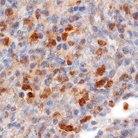 Immunohistochemistry CCR2 Antibody (48607) [Unconjugated]