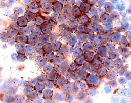 Immunohistochemistry CCR3 Antibody (61828)