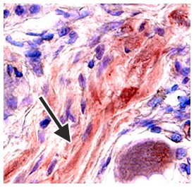 Immunohistochemistry CCR5 Antibody (45523) [Unconjugated]