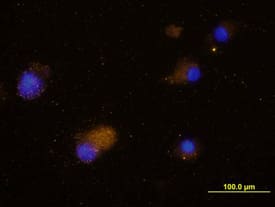 Immunocytochemistry CCR5 Antibody (45531) [Unconjugated]
