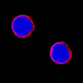 CCR5 was detected in immersion fixed human peripheral blood mononuclear cells (PBMCs) using Mouse Anti-Human CCR5 Monoclonal Antibody (Catalog # MAB183) at 8 µg/mL for 3 hours at room temperature. Cells were stained using the NorthernLights™ 557-conjugated Anti-Mouse IgG Secondary Antibody (red; Catalog # NL007) and counterstained with DAPI (blue). Specific staining was localized to cell surfaces. View our protocol for Fluorescent ICC Staining of Non-adherent Cells.