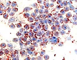 Immunohistochemistry CCR6 Antibody (53103)