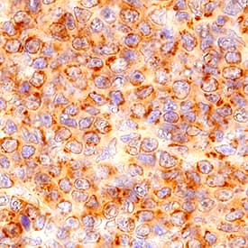 CCR6 was detected in immersion fixed paraffin-embedded sections of mouse spleen using Rat Anti-Mouse CCR6 Monoclonal Antibody (Catalog # MAB590R) at 5 µg/mL for 1 hour at room temperature followed by incubation with the Anti-Mouse IgG VisUCyte™ HRP Polymer Antibody (Catalog # VC001). Tissue was stained using DAB (brown) and counterstained with hematoxylin (blue). Specific staining was localized to cytoplasm and cell surfaces in lymphocytes. View our protocol for IHC Staining with VisUCyte HRP Polymer Detection Reagents.