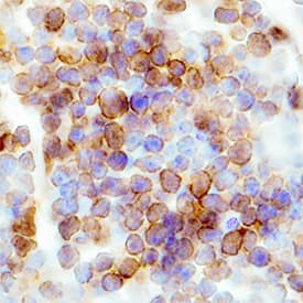 CCR6 was detected in immersion fixed frozen sections of mouse spleen using Rat Anti-Mouse CCR6 Monoclonal Antibody (Catalog # MAB590) at 0.3 µg/mL overnight at 4 °C. Tissue was stained using the Anti-Rat HRP-DAB Cell & Tissue Staining Kit (brown; Catalog # CTS017) and counterstained with hematoxylin (blue). Specific staining was localized to plasma membranes in lymphocytes. View our protocol for Chromogenic IHC Staining of Frozen Tissue Sections.