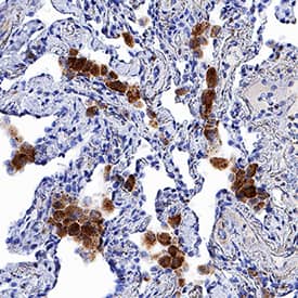 CCR7 was detected in immersion fixed paraffin-embedded sections of human lung using Mouse Anti-Human CCR7 Monoclonal Antibody (Catalog # MAB197) at 5 µg/mL for 1 hour at room temperature followed by incubation with the Anti-Mouse IgG VisUCyte™ HRP Polymer Antibody (Catalog # VC001). Tissue was stained using DAB (brown) and counterstained with hematoxylin (blue). Specific staining was localized to cytoplasm in macrophages. View our protocol for IHC Staining with VisUCyte HRP Polymer Detection Reagents.