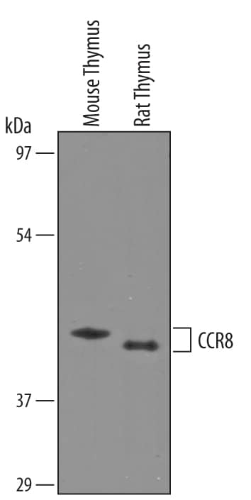 Western blot shows lysates of mouse thymus tissue and rat thymus tissue. PVDF Membrane was probed with 0.5 µg/mL of Sheep Anti-Mouse/Rat CCR8 Antigen Affinity-purified Polyclonal Antibody (Catalog # AF5997) followed by HRP-conjugated Anti-Sheep IgG Secondary Antibody (Catalog # HAF016). A specific band was detected for CCR8 at approximately 41-43 kDa (as indicated). This experiment was conducted under reducing conditions and using Immunoblot Buffer Group 8.