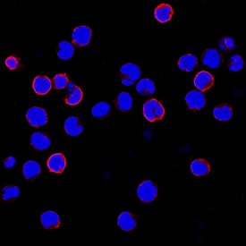 CCR9 was detected in immersion fixed MOLT-4 human acute lymphoblastic leukemia cell line using Mouse Anti-Human CCR9 Monoclonal Antibody (Catalog # MAB1791R) at 8 µg/mL for 3 hours at room temperature. Cells were stained using the NorthernLights™ 557-conjugated Anti-Mouse IgG Secondary Antibody (red; Catalog # NL007) and counterstained with DAPI (blue). Specific staining was localized to cell surfaces. View our protocol for Fluorescent ICC Staining of Non-adherent Cells.