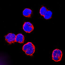 CCR9 was detected in immersion fixed MOLT-4 human acute lymphoblastic leukemia cell line using Mouse Anti-Human CCR9 Monoclonal Antibody (Catalog # MAB1791) at 25 µg/mL for 3 hours at room temperature. Cells were stained using the NorthernLights™ 557-conjugated Anti-Mouse IgG Secondary Antibody (red; Catalog # NL007) and counterstained with DAPI (blue). Specific staining was localized to plasma membrane and cytoplasm. View our protocol for Fluorescent ICC Staining of Non-adherent Cells.