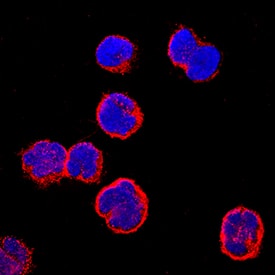 Immunocytochemistry CCR9 Antibody (112509) [Unconjugated]