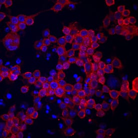 Immunocytochemistry CCRL2/LCCR Antibody (498321)