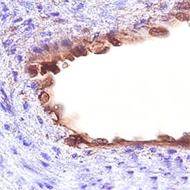 CD109 was detected in immersion fixed paraffin-embedded sections of human placenta using Mouse Anti-Human CD109 Monoclonal Antibody (Catalog # MAB4385) at 10 µg/mL overnight at 4 °C. Tissue was stained using the Anti-Mouse HRP-DAB Cell & Tissue Staining Kit (brown; Catalog # CTS002) and counterstained with hematoxylin (blue). Specific staining was localized to cytoplasm in endothelial cells. View our protocol for Chromogenic IHC Staining of Paraffin-embedded Tissue Sections.