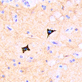 Immunohistochemistry CD117/c-kit Antibody [Unconjugated]