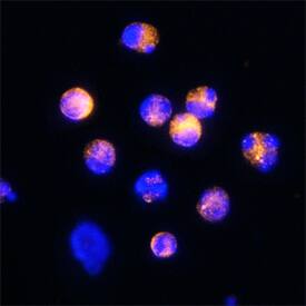 CD160 was detected in immersion fixed CD8+mouse splenocytes using Rat Anti-Mouse CD160 Monoclonal Antibody (Catalog # MAB38991) at 25 µg/mL for 3 hours at room temperature. Cells were stained using the Northern-Lights™ 557-conjugated Anti-Rat IgG Secondary Antibody (yellow; Catalog # NL013) and counterstained with DAPI (blue). Specific staining was localized to plasma membranes and cytoplasm. View our protocol for Fluorescent ICC Staining of Non-adherent Cells.