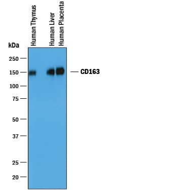 Western blot shows lysates of human thymus tissue, human liver tissue, and human placenta tissue. PVDF membrane was probed with 1 µg/mL of Goat Anti-Human CD163 Antigen Affinity-purified Polyclonal Antibody (Catalog # AF1607) followed by HRP-conjugated Anti-Goat IgG Secondary Antibody (HAF019). A specific band was detected for CD163 at approximately 150 kDa (as indicated). This experiment was conducted under reducing conditions and using Immunoblot Buffer Group 1.