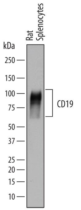 Western blot shows lysates of rat splenocytes. PVDF membrane was probed with 1 µg/mL of Sheep Anti-Rat CD19 Antigen Affinity-purified Polyclonal Antibody (Catalog # AF7489) followed by HRP-conjugated Anti-Sheep IgG Secondary Antibody (Catalog # HAF016). Specific bands were detected for CD19 at approximately 85-100 kDa (as indicated). This experiment was conducted under reducing conditions and using Immunoblot Buffer Group 1.