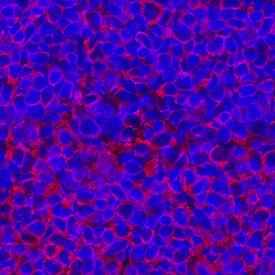 CD19 was detected in immersion fixed frozen sections of rat spleen using Mouse Anti-Rat CD19 Monoclonal Antibody (Catalog # MAB7489R) at 25 µg/mL overnight at 4 °C. Tissue was stained using the NorthernLights™ 557-conjugated Anti-Mouse IgG Secondary Antibody (red; Catalog # NL007) and counterstained with DAPI (blue). Specific staining was localized to cell surfaces. View our protocol for Fluorescent IHC Staining of Frozen Tissue Sections.