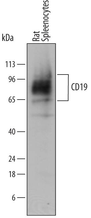 Western blot shows lysates of rat splenocytes. PVDF membrane was probed with 1 µg/mL of Mouse Anti-Rat CD19 Monoclonal Antibody (Catalog # MAB7489) followed by HRP-conjugated Anti-Mouse IgG Secondary Antibody (Catalog # HAF018). Specific bands were detected for CD19 at approximately 60-110 kDa (as indicated). This experiment was conducted under reducing conditions and using Immunoblot Buffer Group 1.