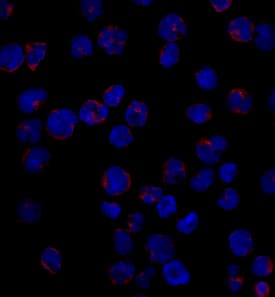 CD1a was detected in immersion fixed MOLT-4 human acute lymphoblastic leukemia cell line using Mouse Anti-Human CD1a Monoclonal Antibody (Catalog # MAB7076) at 10 µg/mL for 3 hours at room temperature. Cells were stained using the NorthernLights™ 557-conjugated Anti-Mouse IgG Secondary Antibody (red; NL007) and counterstained with DAPI (blue). Specific staining was localized to surface and cytoplasm. View our protocol for Fluorescent ICC Staining of Non-adherent Cells.