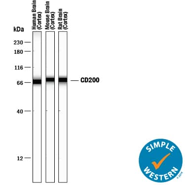 Simple Western lane view shows lysates of human, mouse, and rat brain (cortex) tissue, loaded at 0.2 mg/mL. A specific band was detected for CD200 at approximately 70-75 kDa (as indicated) using 10 µg/mL of Goat Anti-Human/Mouse/Rat CD200 Antigen Affinity-purified Polyclonal Antibody (Catalog # AF2724) followed by 1:50 dilution of HRP-conjugated Anti-Goat IgG Secondary Antibody (Catalog # HAF109). This experiment was conducted under reducing conditions and using the 12-230 kDa separation system.