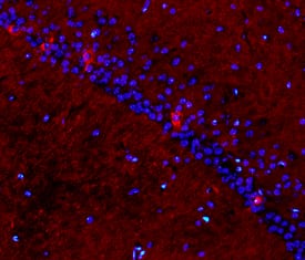 CD200 was detected in perfusion fixed frozen sections of normal mouse brain using Goat Anti-Mouse/Rat CD200 Antigen Affinity-purified Polyclonal Antibody (Catalog # AF3355) at 15 µg/mL overnight at 4 °C. Tissue was stained using the NorthernLights™ 557-conjugated Anti-Goat IgG Secondary Antibody (red; Catalog # NL001) and counterstained with DAPI (blue). Specific staining was localized to plasma membranes of hippocampal neurons. View our protocol for Fluorescent IHC Staining of Frozen Tissue Sections.