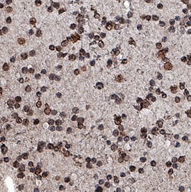 CD20 was detected in immersion fixed paraffin-embedded sections of human leukemia using Mouse Anti-Human CD20 Monoclonal Antibody (Catalog # MAB4225) at 15 µg/mL for 1 hour at room temperature followed by incubation with the Anti-Mouse IgG VisUCyte™ HRP Polymer Antibody (Catalog # VC001). Tissue was stained using DAB (brown) and counterstained with hematoxylin (blue). Specific staining was localized to lymphocytes. View our protocol for IHC Staining with VisUCyte HRP Polymer Detection Reagents.