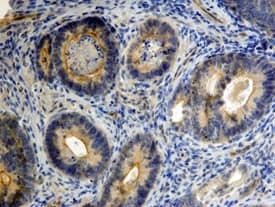 CD24 was detected in immersion fixed paraffin-embedded sections of human colon using 15 &micro;g/mL Human CD24 Monoclonal Antibody (Catalog # MAB5248) overnight at 4 &deg;C. Tissue was stained with the Anti-Mouse HRP-DAB Cell & Tissue Staining Kit (brown; Catalog # CTS002) and counterstained with hematoxylin (blue). View our protocol for Chromogenic IHC Staining of Paraffin-embedded Tissue Sections.