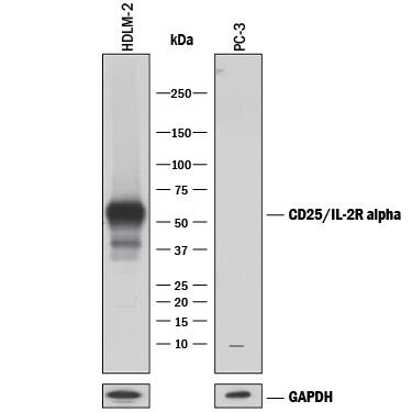 Western blot shows lysates of HDLM-2 human Hodgkin's lymphoma cell line and PC-3 human prostate cancer cell line (negative control). PVDF membrane was probed with 1 µg/mL of Goat Anti-Human CD25/IL-2R alpha Antigen Affinity-purified Polyclonal Antibody (Catalog # AF-223-NA) followed by HRP-conjugated Anti-Goat IgG Secondary Antibody (Catalog # HAF017). A specific band was detected for CD25/IL-2R alpha at approximately 60 kDa (as indicated). GAPDH (AF5718) is shown as a loading control.This experiment was conducted under reducing conditions and using Immunoblot Buffer Group 1.